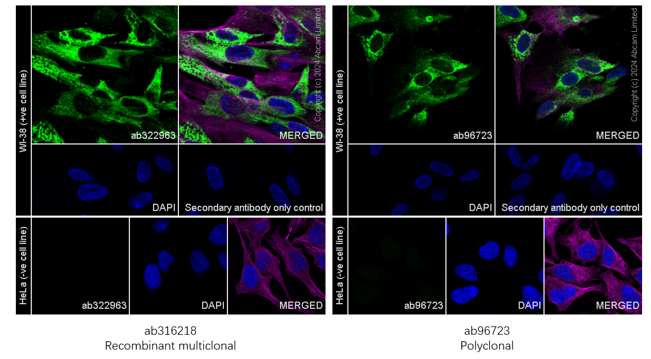 Immunocytochemistry/ Immunofluorescence - Anti-COL1A2 antibody [RM1295] (ab322963), expandable thumbnail