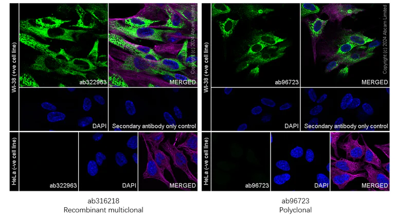 Immunocytochemistry/ Immunofluorescence - Anti-COL1A2 antibody [RM1295] (AB322963)
