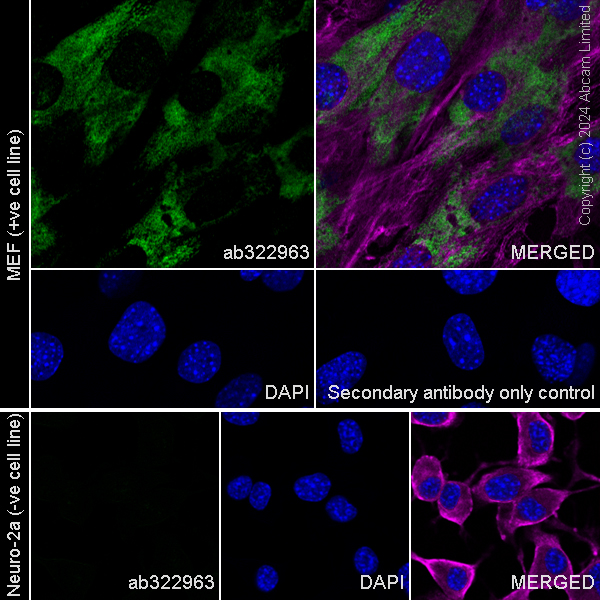 Immunocytochemistry/ Immunofluorescence - Anti-COL1A2 antibody [RM1295] (ab322963), expandable thumbnail