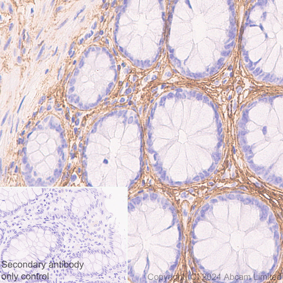 Immunohistochemistry (Formalin/PFA-fixed paraffin-embedded sections) - Anti-COL1A2 antibody [RM1295] (ab322963), expandable thumbnail