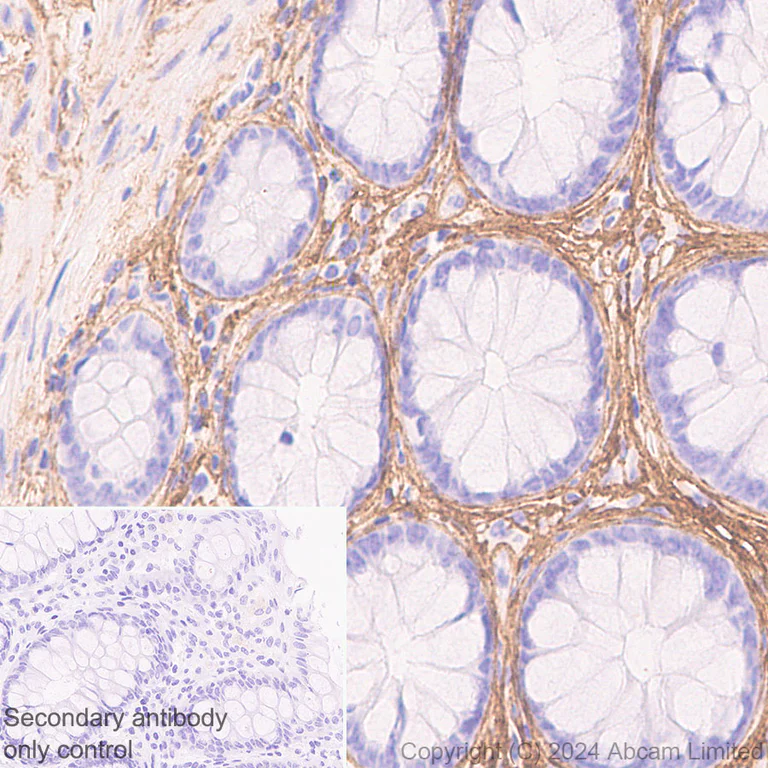 Immunohistochemistry (Formalin/PFA-fixed paraffin-embedded sections) - Anti-COL1A2 antibody [RM1295] (AB322963)