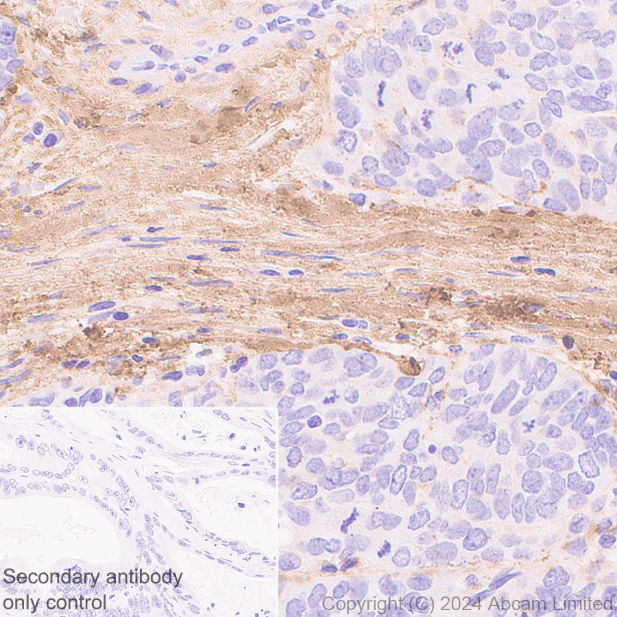 Immunohistochemistry (Formalin/PFA-fixed paraffin-embedded sections) - Anti-COL1A2 antibody [RM1295] (ab322963), expandable thumbnail