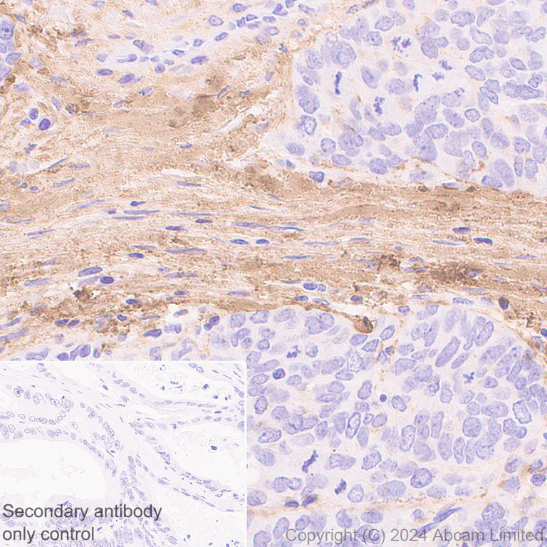 Immunohistochemistry (Formalin/PFA-fixed paraffin-embedded sections) - Anti-COL1A2 antibody [RM1295] (AB322963)