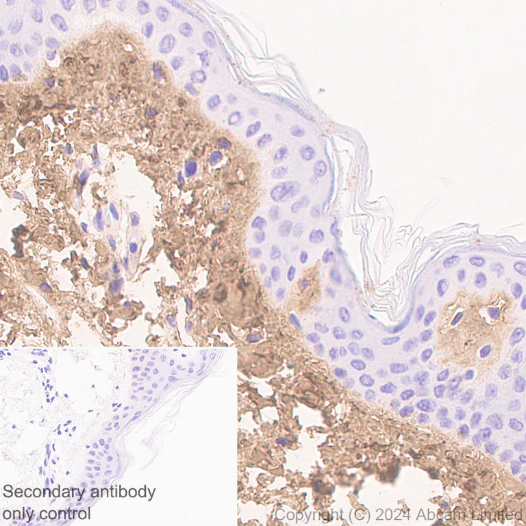 Immunohistochemistry (Formalin/PFA-fixed paraffin-embedded sections) - Anti-COL1A2 antibody [RM1295] (AB322963)