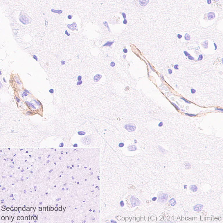 Immunohistochemistry (Formalin/PFA-fixed paraffin-embedded sections) - Anti-COL1A2 antibody [RM1295] (AB322963)