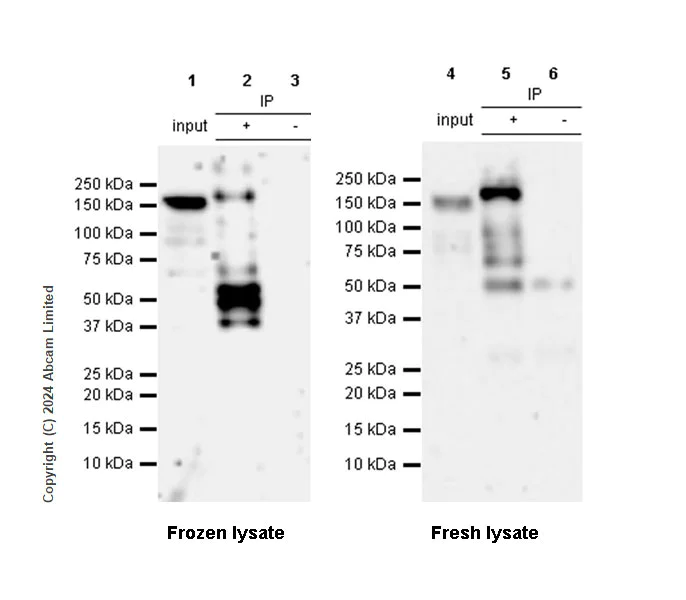 Immunoprecipitation - Anti-COL1A2 antibody [RM1295] (AB322963)