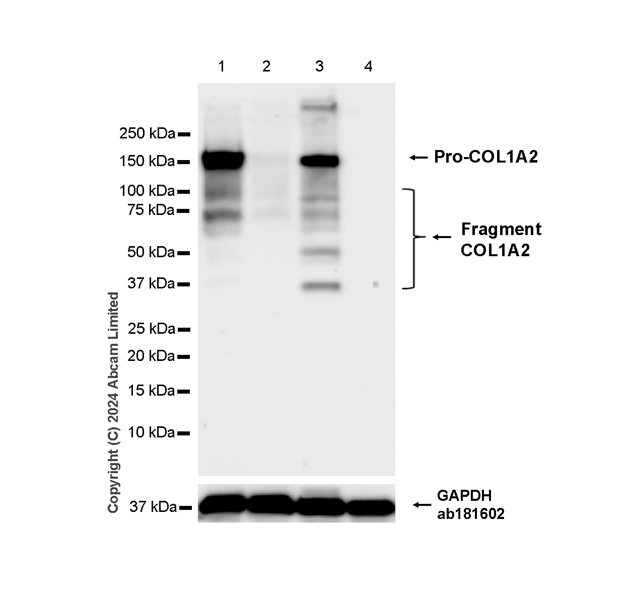 Western blot - Anti-COL1A2 antibody [RM1295] (AB322963), expandable thumbnail