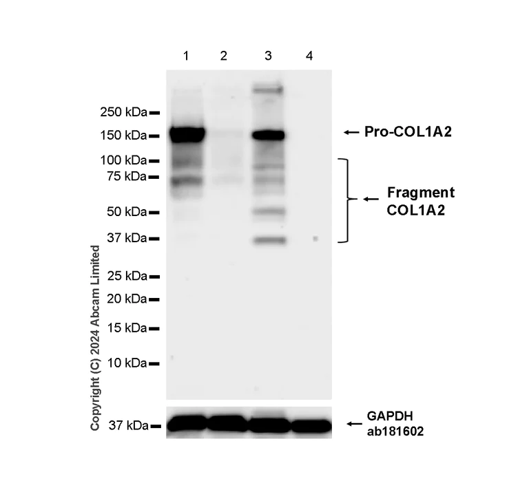 Western blot - Anti-COL1A2 antibody [RM1295] (AB322963)
