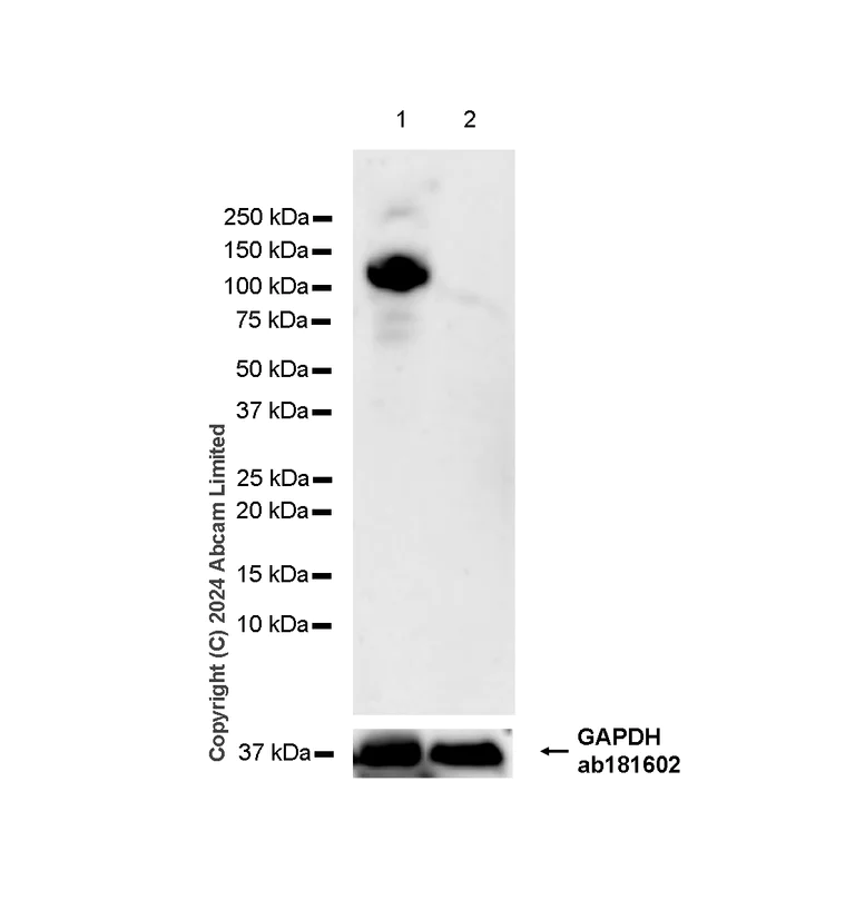 Western blot - Anti-COL1A2 antibody [RM1295] (AB322963)