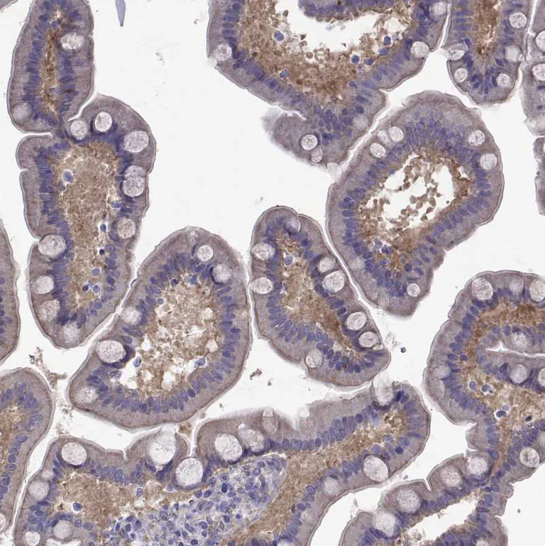 Immunohistochemistry (Formalin/PFA-fixed paraffin-embedded sections) - Anti-COL22A1 antibody (AB121846)
