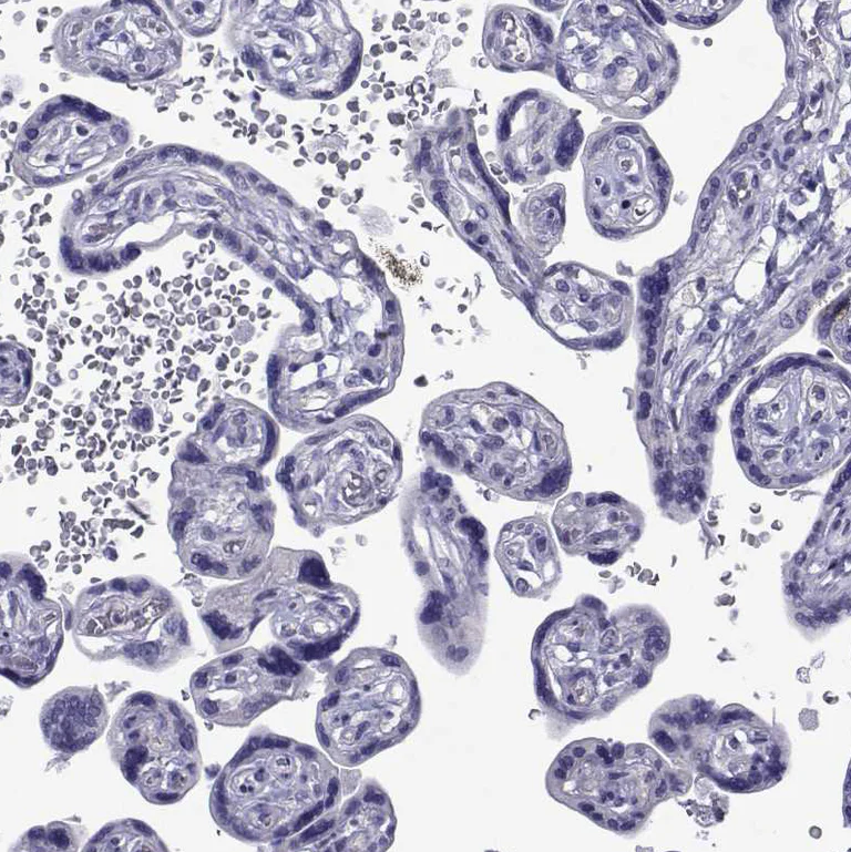 Immunohistochemistry (Formalin/PFA-fixed paraffin-embedded sections) - Anti-COL22A1 antibody (AB121846)