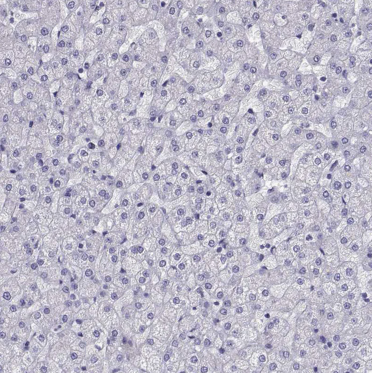 Immunohistochemistry (Formalin/PFA-fixed paraffin-embedded sections) - Anti-COL22A1 antibody (AB121846)