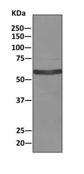 Western blot - Anti-COL23A1 antibody [EPR6066(2)(B)] (AB168356)
