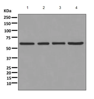 Western blot - Anti-COL23A1 antibody [EPR6066(2)(B)] - BSA and Azide free (AB249452)