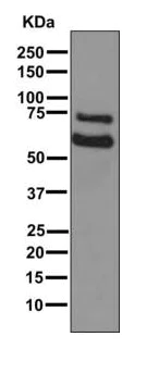 Western blot - Anti-COL23A1 antibody [EPR6066(2)(B)] - BSA and Azide free (AB249452)