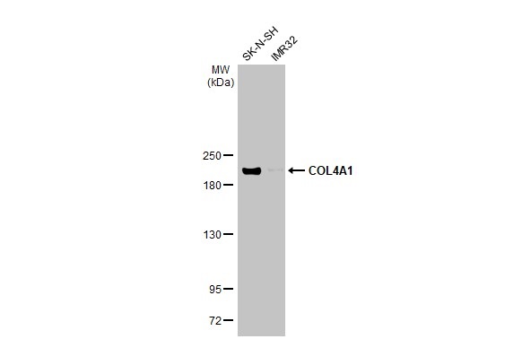 Western blot - Anti-COL4A1 antibody [HL1351] (AB308360), expandable thumbnail