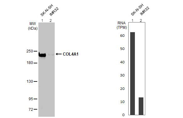 Western blot - Anti-COL4A1 antibody [HL1351] (AB308360), expandable thumbnail