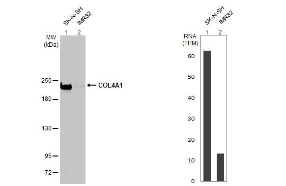 Western blot - Anti-COL4A1 antibody [HL1351] (AB308360)