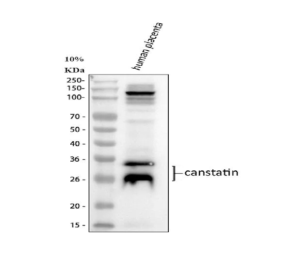 Western blot - Anti-COL4A2 antibody (AB125208)