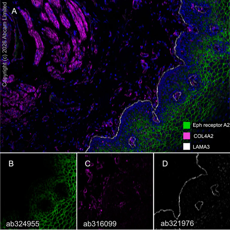 Multiplex immunohistochemistry - Anti-COL4A2 antibody [EPR25363-49] - BSA and Azide free (AB316100)