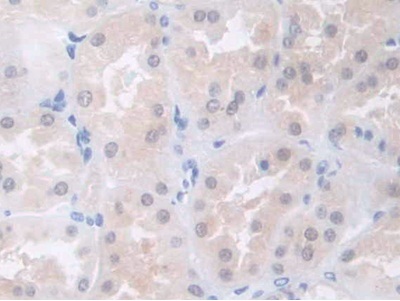 Immunohistochemistry (Formalin/PFA-fixed paraffin-embedded sections) - Anti-COL4A5 antibody (AB231957), expandable thumbnail