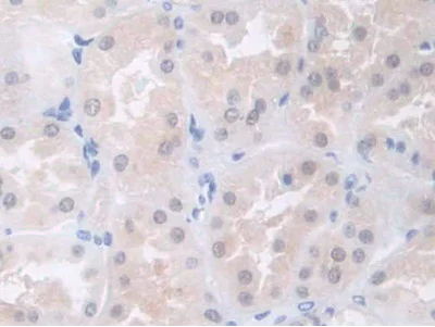 Immunohistochemistry (Formalin/PFA-fixed paraffin-embedded sections) - Anti-COL4A5 antibody (AB231957)