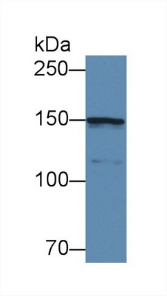 Western blot - Anti-COL4A5 antibody (AB231957), expandable thumbnail