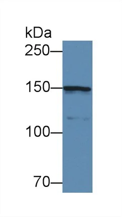 Western blot - Anti-COL4A5 antibody (AB231957)