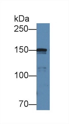Western blot - Anti-COL4A5 antibody (AB231957), expandable thumbnail