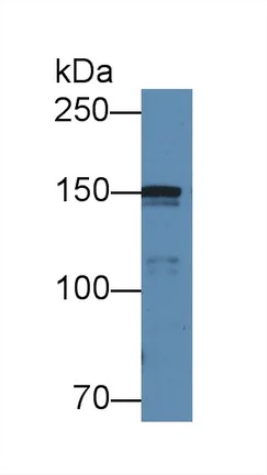 Western blot - Anti-COL4A5 antibody (AB231957)