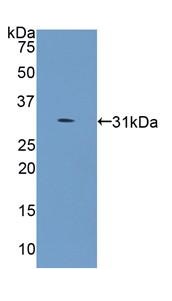 Western blot - Anti-COL4A5 antibody (AB231957), expandable thumbnail