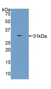 Western blot - Anti-COL4A5 antibody (AB231957)