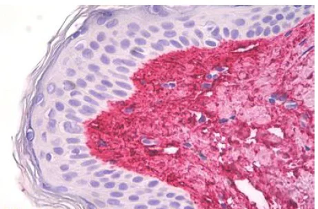 Immunohistochemistry (Formalin/PFA-fixed paraffin-embedded sections) - Anti-COL5A1 antibody (AB189285)
