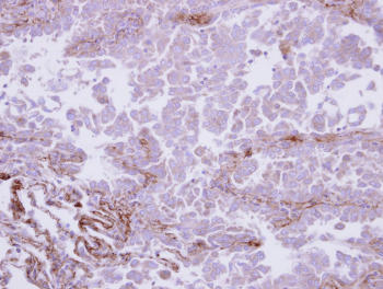 Immunohistochemistry (Formalin/PFA-fixed paraffin-embedded sections) - Anti-COL6A1 antibody (AB151422), expandable thumbnail
