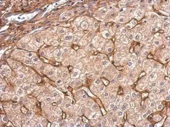 Immunohistochemistry (Formalin/PFA-fixed paraffin-embedded sections) - Anti-COL6A1 antibody (AB151422)