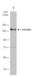 Western blot - Anti-COL6A1 antibody (AB151422)