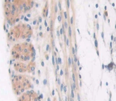 Immunohistochemistry (Formalin/PFA-fixed paraffin-embedded sections) - Anti-COL6A3 antibody (AB231025)