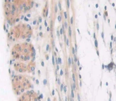 Immunohistochemistry (Formalin/PFA-fixed paraffin-embedded sections) - Anti-COL6A3 antibody (AB231025)