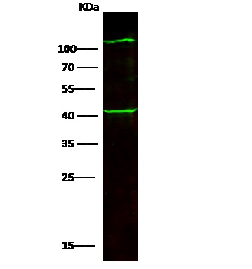 Western blot - Anti-COL6A3 antibody (AB275680)