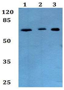Western blot - Anti-COL8A1 antibody (AB192350)