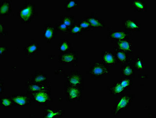 Immunocytochemistry/ Immunofluorescence - Anti-COL8A1 antibody (AB236653)