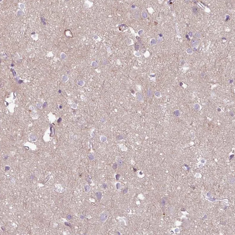 Immunohistochemistry (Formalin/PFA-fixed paraffin-embedded sections) - Anti-COL8A1 antibody (AB251946)