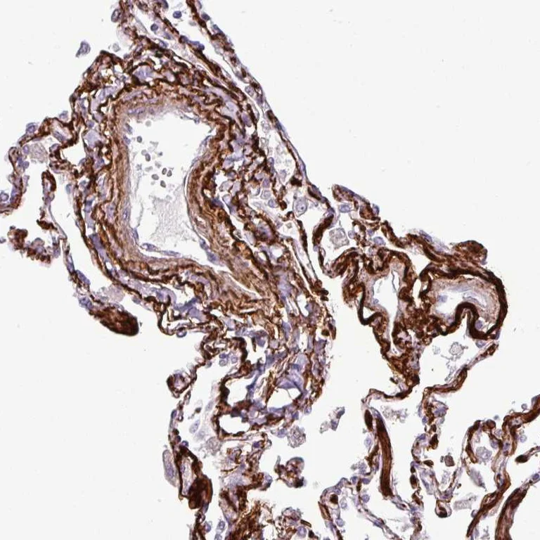 Immunohistochemistry (Formalin/PFA-fixed paraffin-embedded sections) - Anti-COL8A1 antibody (AB251946)