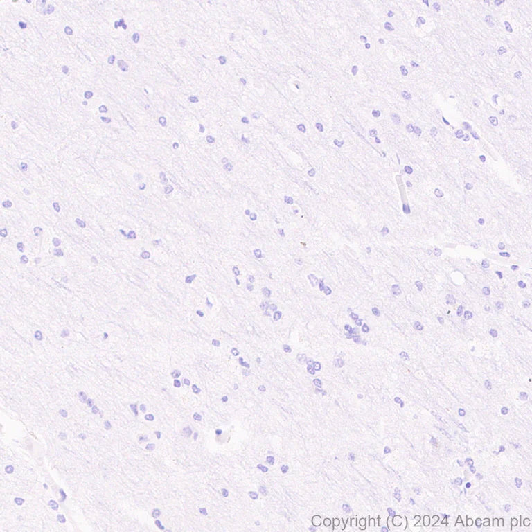 Immunohistochemistry (Formalin/PFA-fixed paraffin-embedded sections) - Anti-COL8A1 antibody [EPR28738-178] (AB318972)