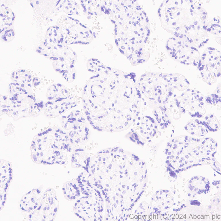Immunohistochemistry (Formalin/PFA-fixed paraffin-embedded sections) - Anti-COL8A1 antibody [EPR28738-178] (AB318972)