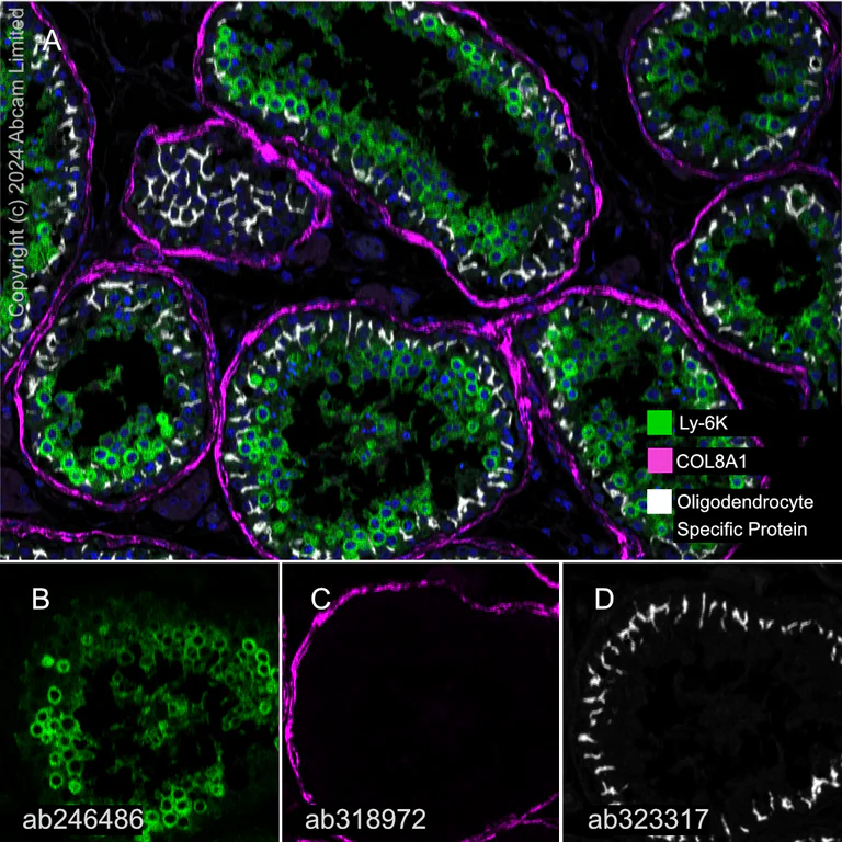 Multiplex immunohistochemistry - Anti-COL8A1 antibody [EPR28738-178] (AB318972)