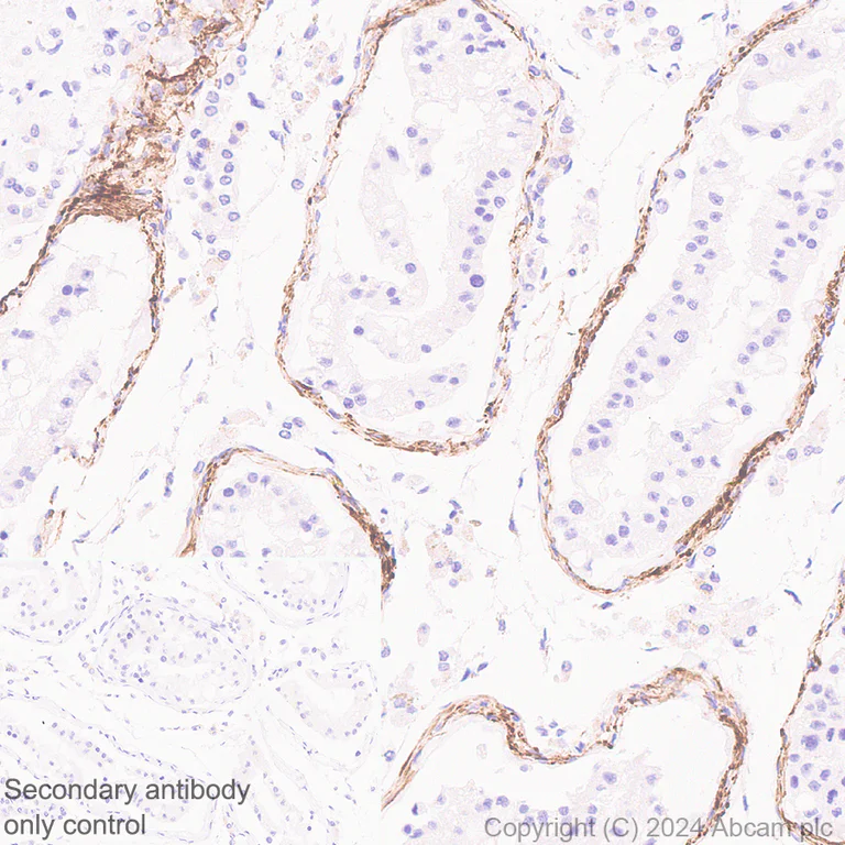 Immunohistochemistry (Formalin/PFA-fixed paraffin-embedded sections) - Anti-COL8A1 antibody [EPR28738-178] - BSA and Azide free (AB318973)