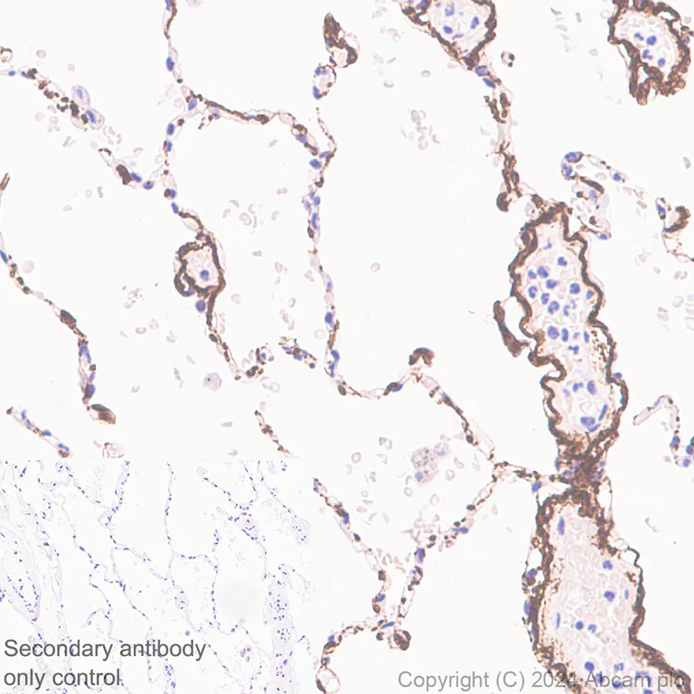 Immunohistochemistry (Formalin/PFA-fixed paraffin-embedded sections) - Anti-COL8A1 antibody [EPR28738-178] - BSA and Azide free (AB318973)