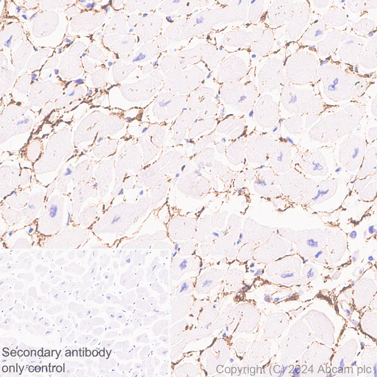 Immunohistochemistry (Formalin/PFA-fixed paraffin-embedded sections) - Anti-COL8A1 antibody [EPR28738-178] - BSA and Azide free (AB318973)