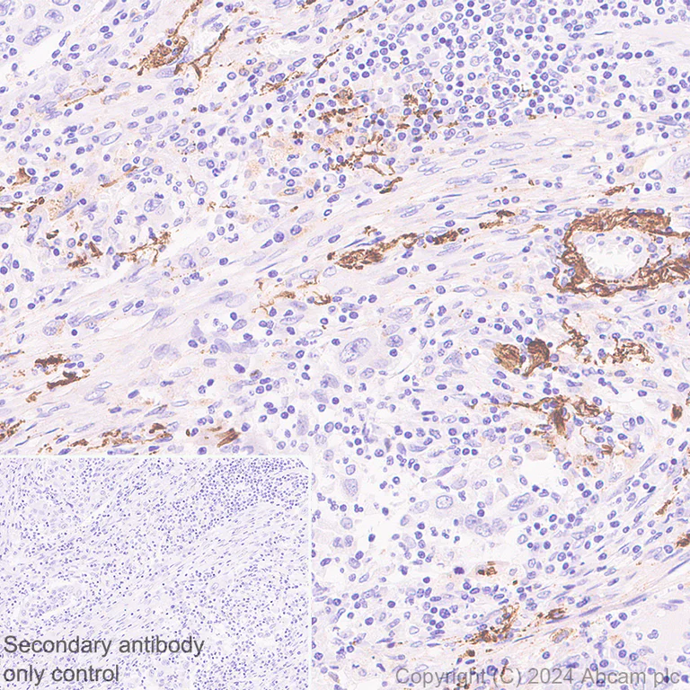 Immunohistochemistry (Formalin/PFA-fixed paraffin-embedded sections) - Anti-COL8A1 antibody [EPR28738-178] - BSA and Azide free (AB318973)